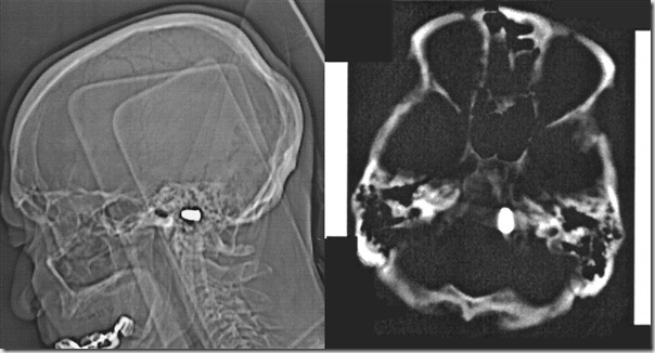 выстрел в голову